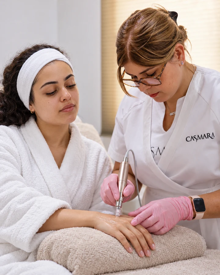 Microneedling mains — Pause Beauté